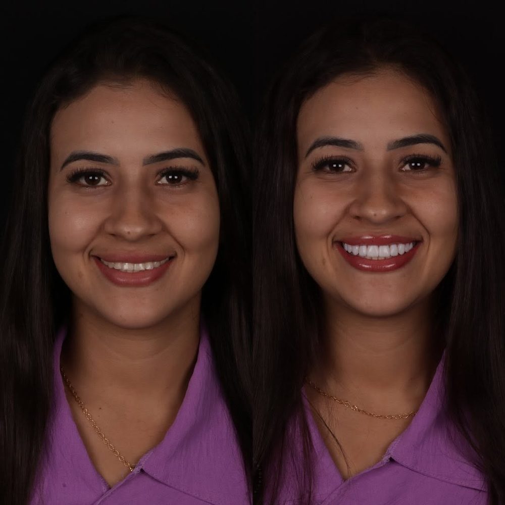 Antes e depois de paciente da Royale