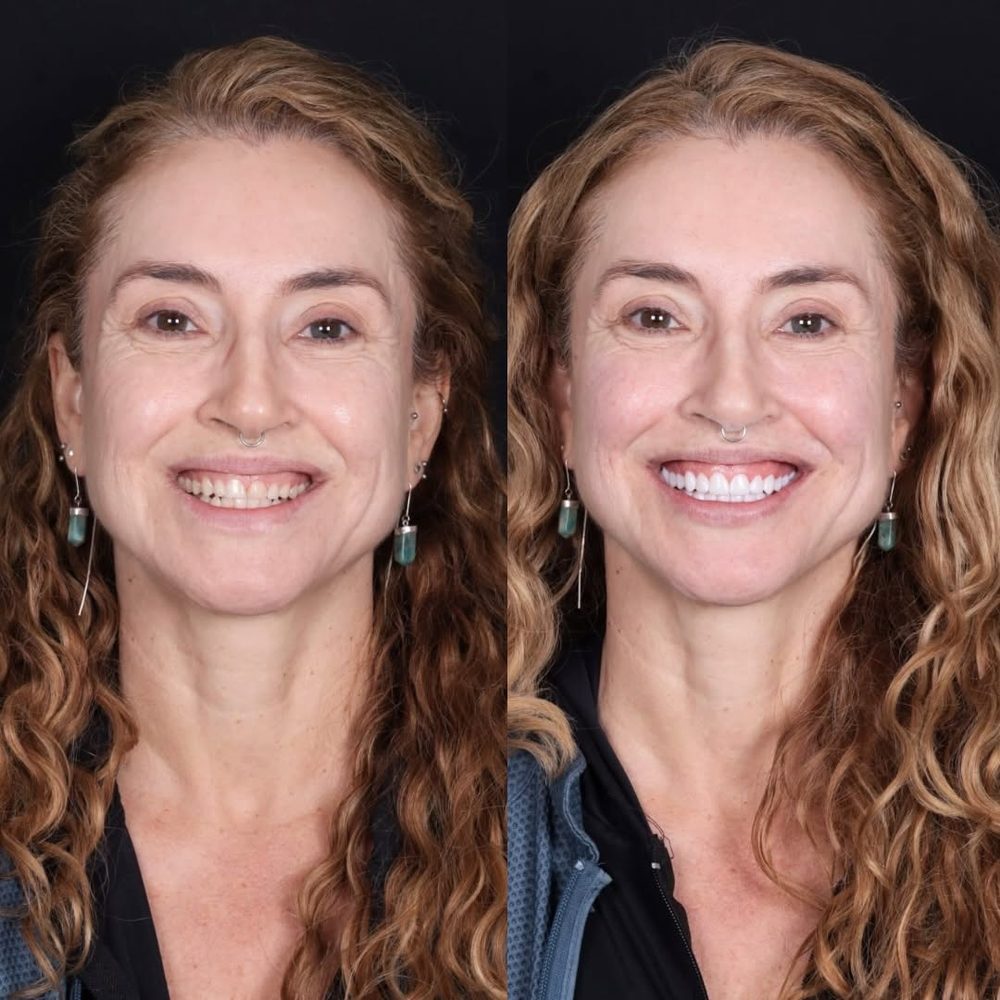 Antes e depois de paciente da Royale